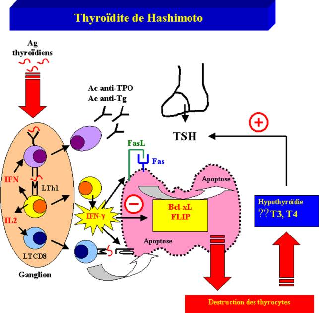 hypothyroïdie auto immune 